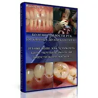 Болезни полости рта: от кариеса до пародонтита